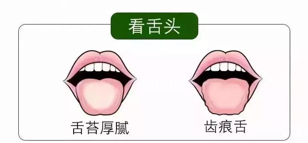 清明時節(jié)雨紛紛 疏通經(jīng)絡(luò)馬上給身體加分！