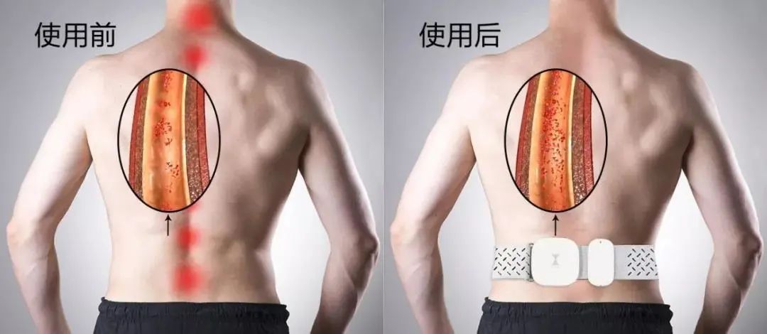 清明時節(jié)雨紛紛 疏通經(jīng)絡(luò)馬上給身體加分！